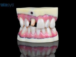 Stratasys J720 Dental Model