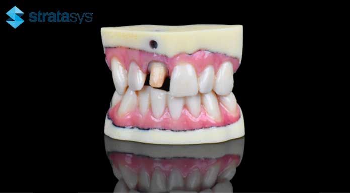 Stratasys J720 Dental Model
